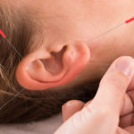 Closeup of hand performing acupuncture therapy on auricle at salon